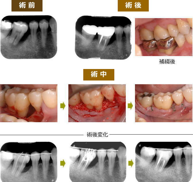 歯周病・歯周組織再生療法 | ひぐち歯科 – 笑顔は口元から（公式ページ