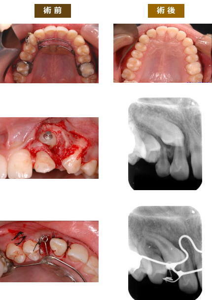 矯正症例７