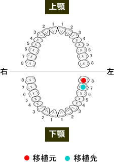 歯列1