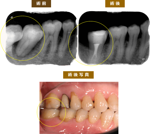 症例2