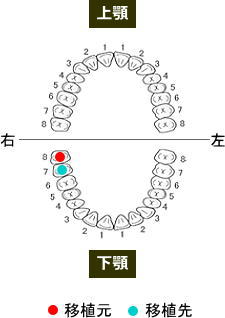 歯列3