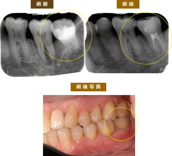 症例1